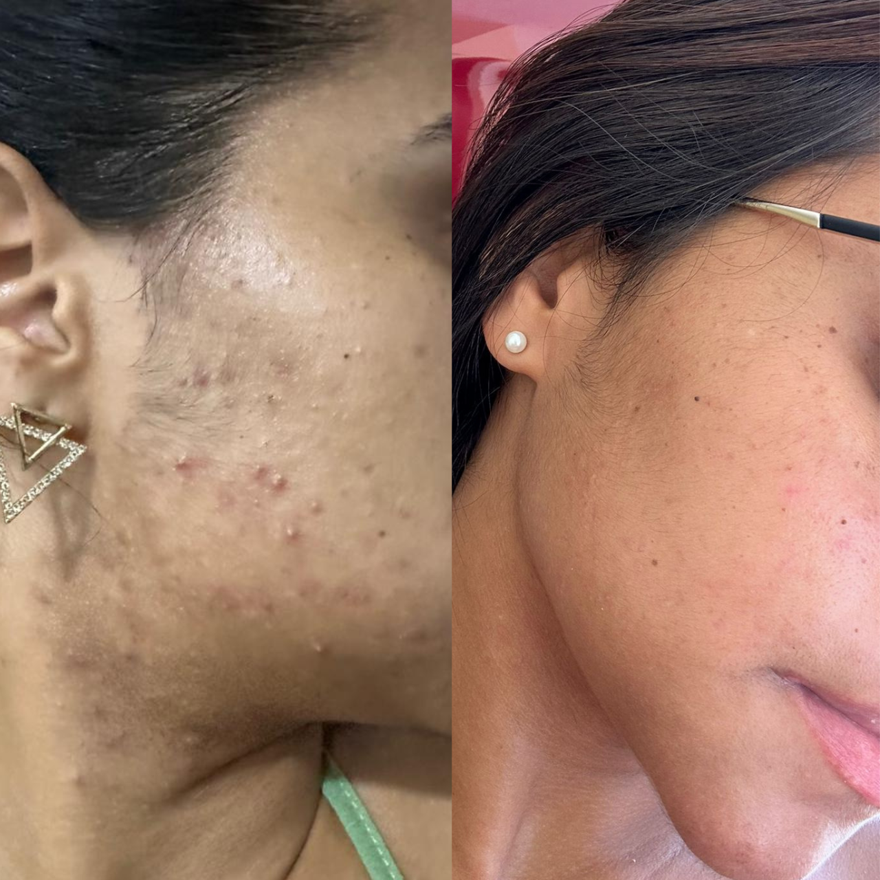 antes e depois 2