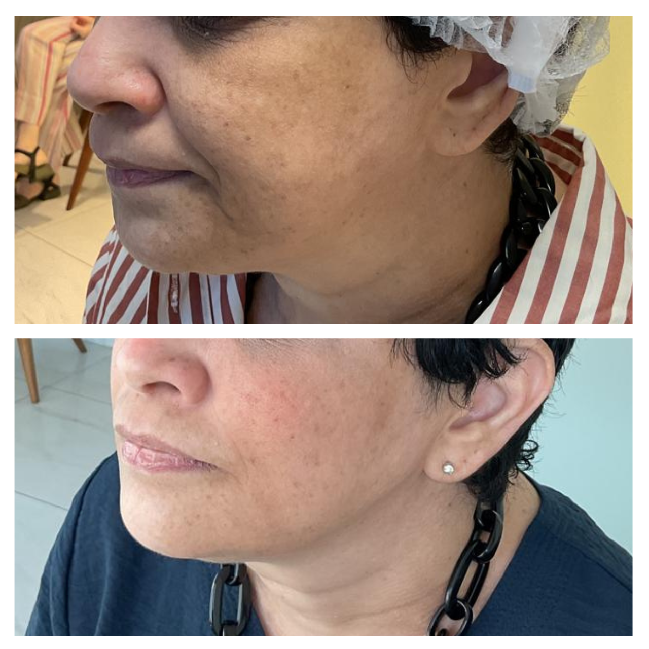 antes e depois - Rita rosa