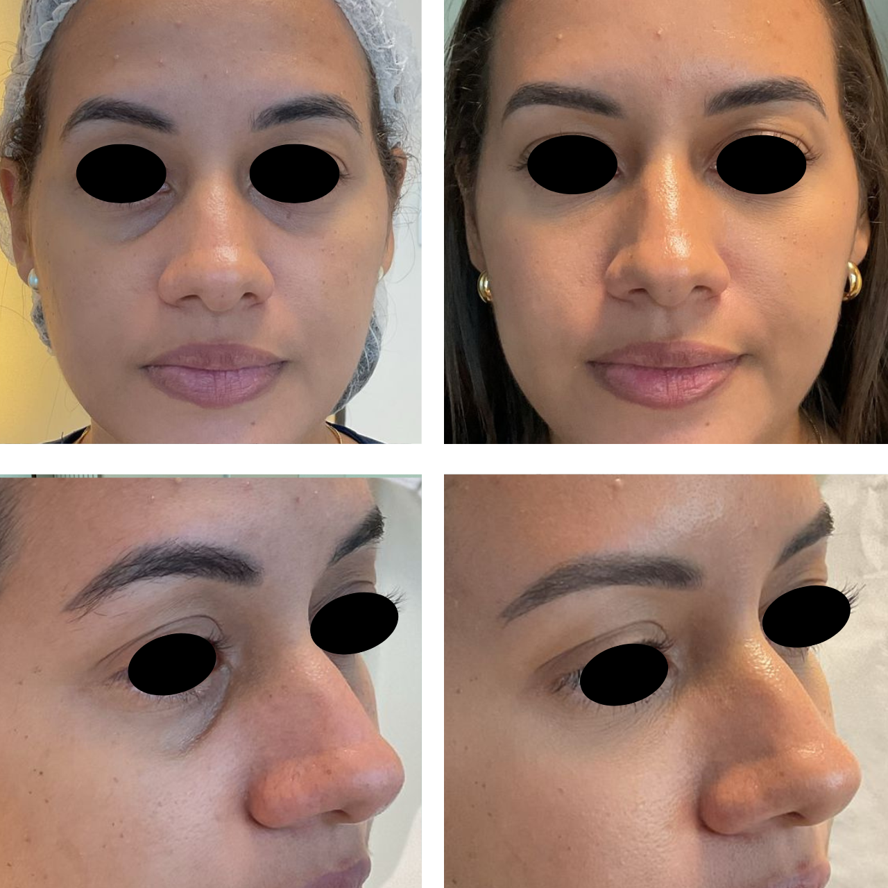 antes e depois - Rita rosa4